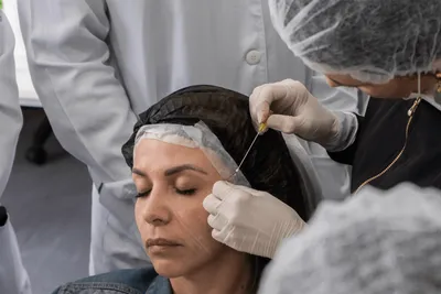 curso de FIOS PDO FACIAL