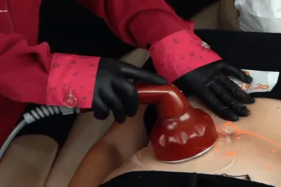Curso Hidrolipoclasia Não Aspirativa Online